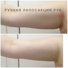 Центр коррекции фигуры Силуэт фотография 5