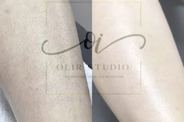 Студия косметологии Olir.studio фотография 2